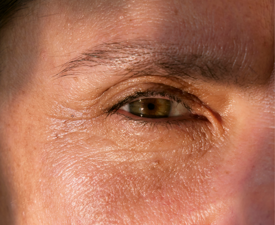 Grande plano da região dos olhos de uma mulher, com textura natural da pele e pequenas linhas de expressão.